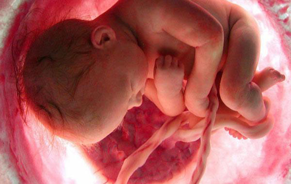 Миома матки и беременность: ведение беременности, осложнения, родоразрешение