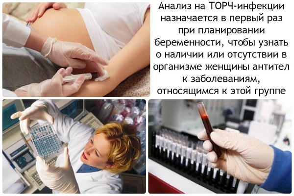 Анализ крови torch у беременных thumbnail