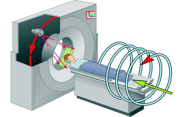 Как проводится компьютерная томография