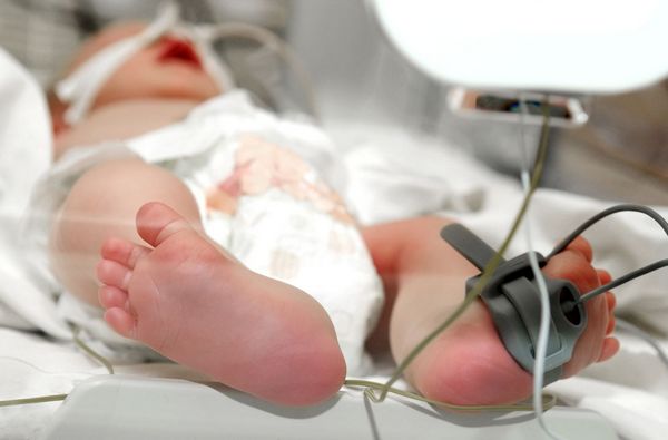 Адреногенитальный синдром у новорожденного